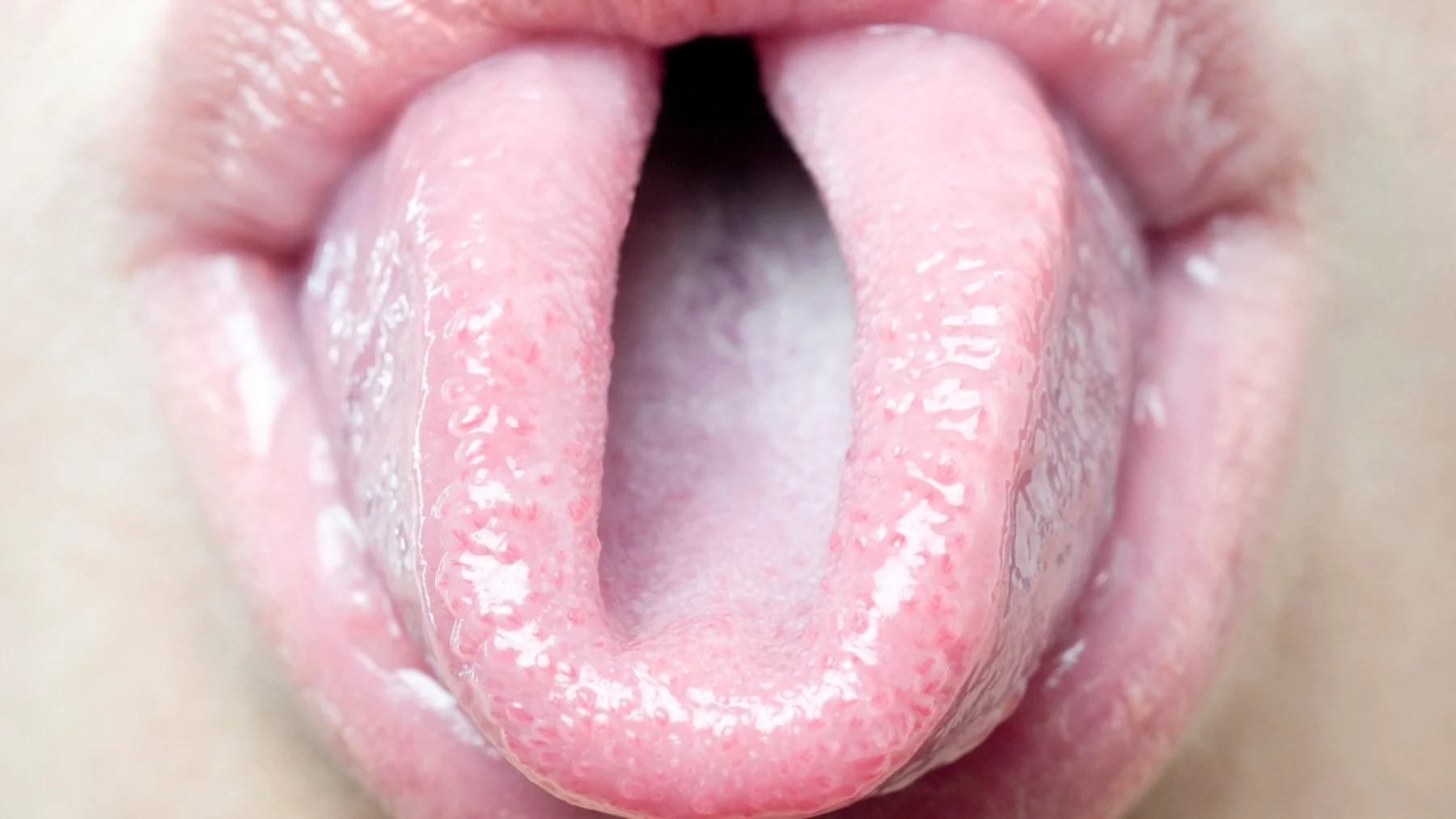 descubre por qué puedes doblar la lengua en forma de u descubre por qué puedes doblar la lengua en forma de u