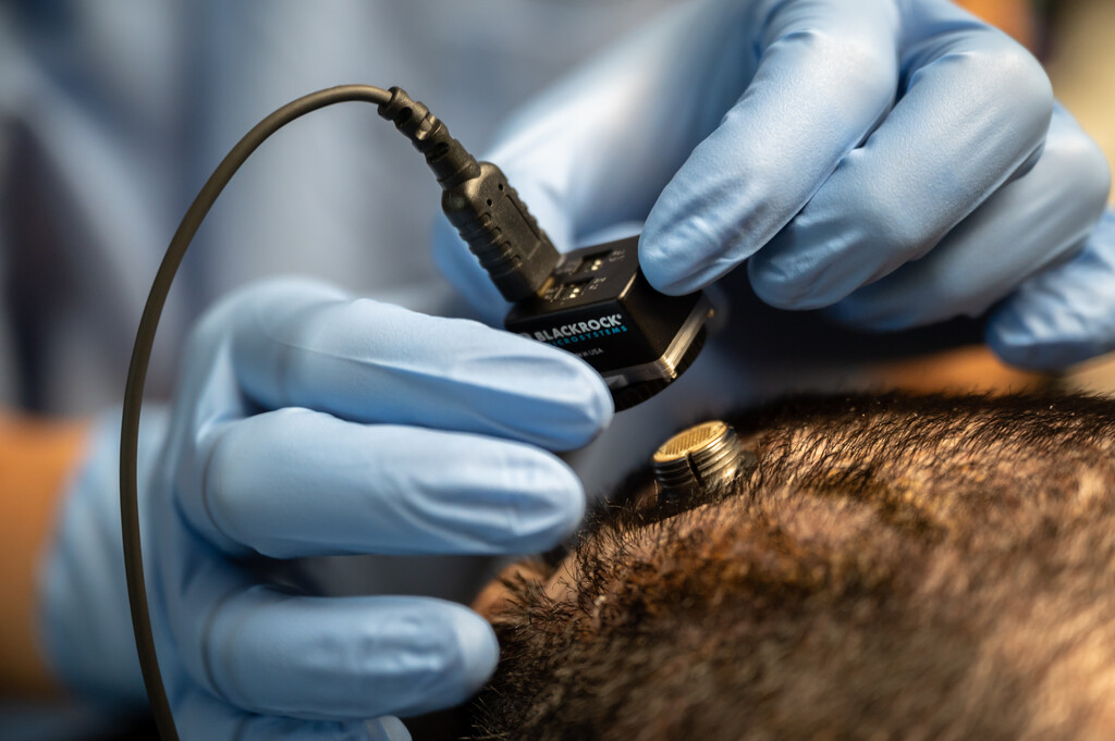 descubre el biocable que podría reparar tu cerebro descubre el biocable que podría reparar tu cerebro