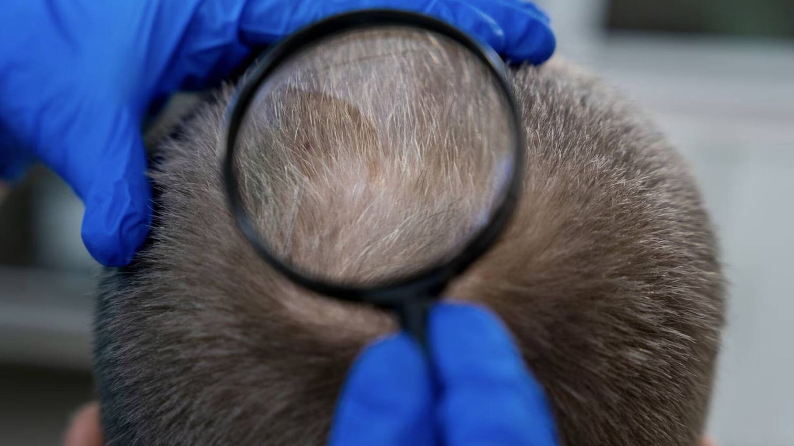 Descubre por qué las canas pueden ser una señal de defensa contra el cáncer y qué revela el nuevo estudio japonés Descubre por qué las canas pueden ser una señal de defensa contra el cáncer y qué revela el nuevo estudio japonés