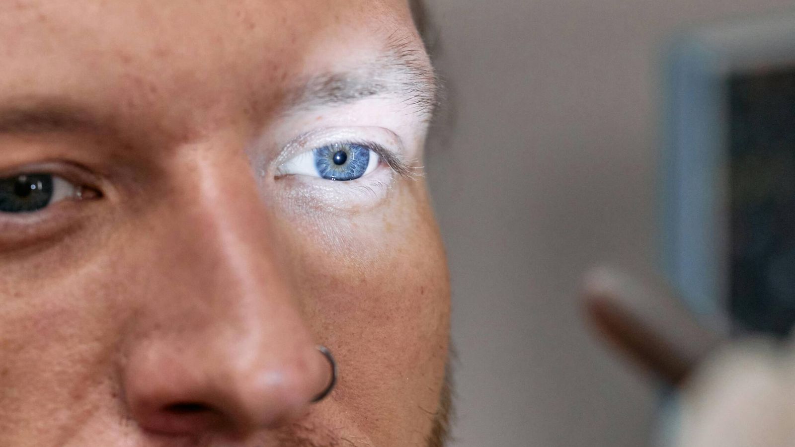 Ensayo clínico logra devolver la lectura a pacientes con ceguera por degeneración macular usando células madre Ensayo clínico logra devolver la lectura a pacientes con ceguera por degeneración macular usando células madre