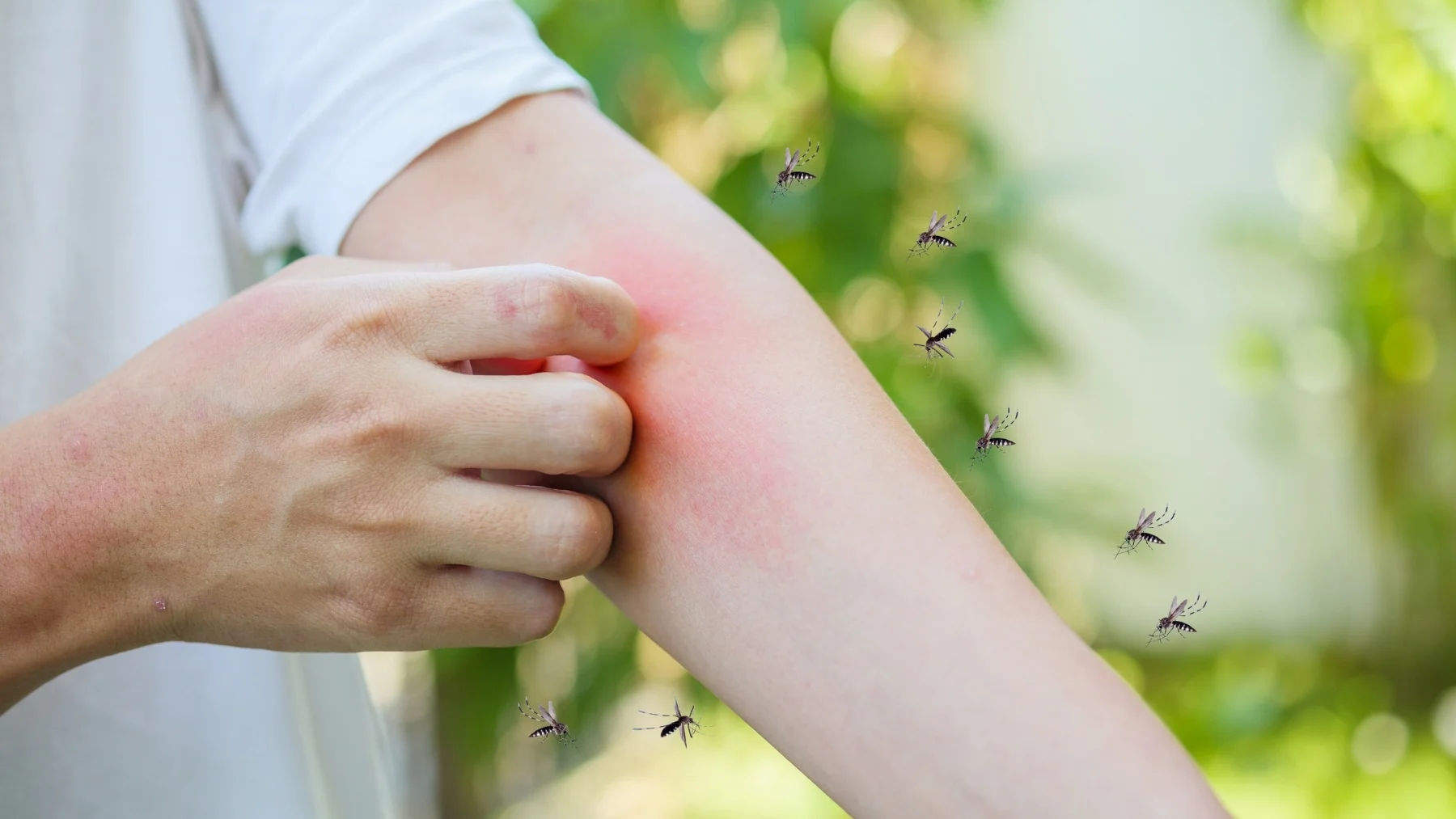¿Por qué los mosquitos pican más a algunas personas que a otras? ¿Por qué los mosquitos pican más a algunas personas que a otras?