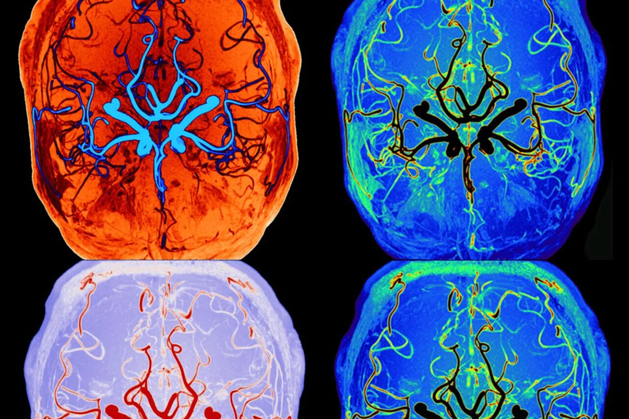 how your brain cleans itself while you sleep how your brain cleans itself while you sleep