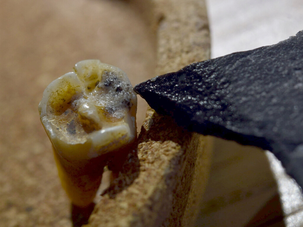 Un neandertal fue el primer dentista hace 60.000 años Un neandertal fue el primer dentista hace 60.000 años