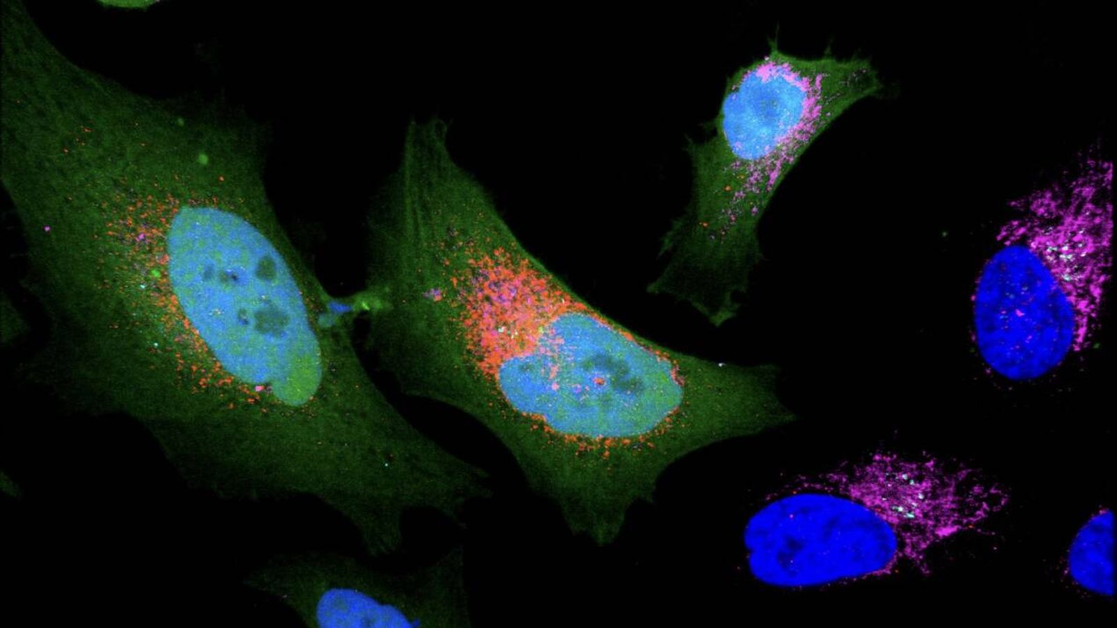 Alemania descubre 1.785 proteínas ocultas en el cuerpo humano que no sabe para qué sirven Alemania descubre 1.785 proteínas ocultas en el cuerpo humano que no sabe para qué sirven